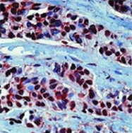PAB13569 - HSP90AA1 / HSP90 alpha