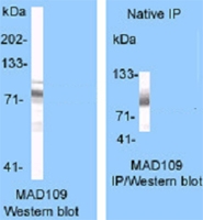 PAB13570 - Endoplasmin / HSP90B1 / TRA1
