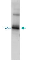 PAB13578 - Estrogen receptor alpha / beta