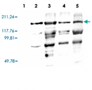 PAB13582 - Vitellogenin