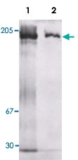 PAB13585 - Murinoglobulin-1