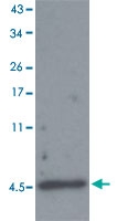 PAB13588 - Amyloid beta