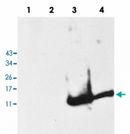 PAB13589 - Alpha-Synuclein / SNCA