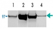 PAB13592 - Glycogen phosphorylase muscle form
