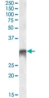 PAB13670 - DLX5