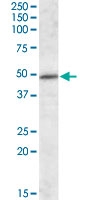 PAB13672 - HIP1-interacting protein