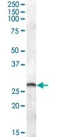 PAB13675 - Phosphoserine phosphatase