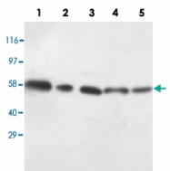 PAB13677 - AKT1/AKT2