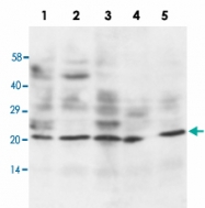 PAB13679 - Apolipoprotein A I / APO AI