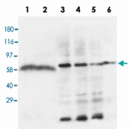 PAB13684 - Lipoprotein lipase