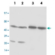 PAB13685 - NR1H3