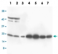 PAB13687 - S100B