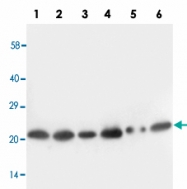 PAB13688 - SCN1B