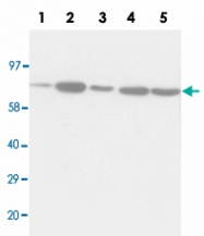 PAB13689 - Complex II subunit 70 kDa Fp