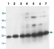 PAB13690 - TFPI2