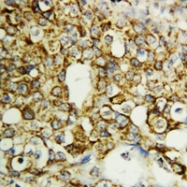 PAB13690 - TFPI2