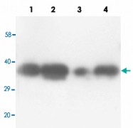 PAB13691 - TNFAIP1 / EDP1
