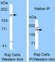 PAB13698 - TOP2A