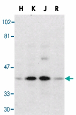 PAB13712 - DFFB / CAD