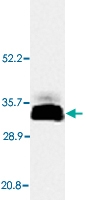 PAB13762 - Adiponectin