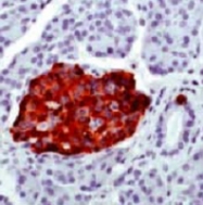 PAB13768 - Chromogranin A