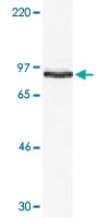 PAB13774 - STAT6