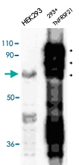 PAB13779 - TNFRSF21 / Death receptor 6 (DR6)