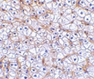 PAB13804 - CD266 / TweakR