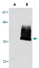 PAB13804 - CD266 / TweakR