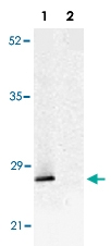 PAB13806 - TP53INP1