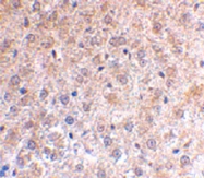 PAB13806 - TP53INP1