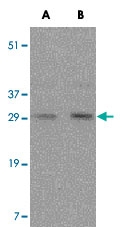 PAB13808 - FAIM3 / TOSO