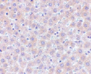 PAB13808 - FAIM3 / TOSO