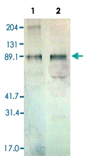 PAB13838 - Thrombopoietin