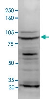 PAB14046 - DNMT3B