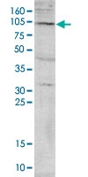 PAB14053 - PADI4