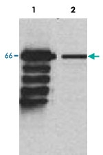 PAB14057 - MBD4