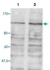 PAB14061 - BRD2