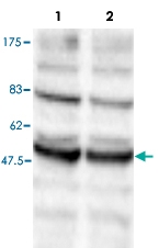 PAB14062 - DNMT2 / TRDMT1