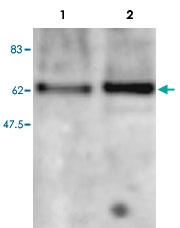 PAB14065 - MBD2