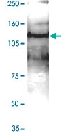 PAB14072 - JMJD2C / KDM4C