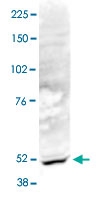 PAB14085 - ACTL6B
