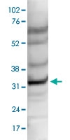PAB14087 - CCDC101 / SGF29