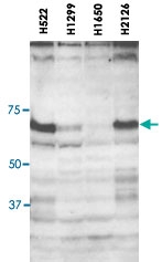PAB14092 - SOX4