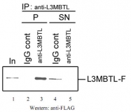 PAB14105 - L3MBTL1