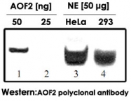 PAB14107 - AOF2