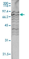 PAB14108 - SUZ12