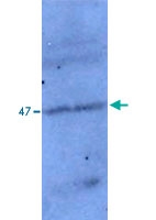 PAB14117 - TP53I11
