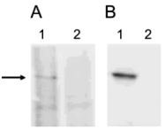 PAB14134 - AOF2