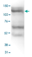 PAB14135 - JMJD2A / KDM4A